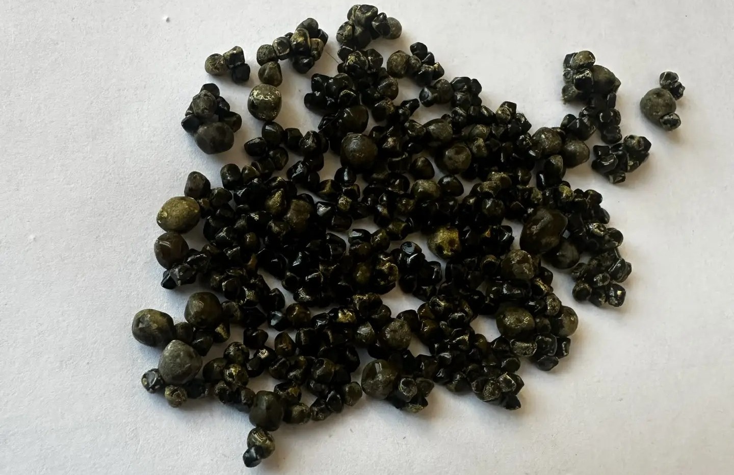 В Балакове прооперировали пациентку с набитым камнями желчным пузырем